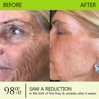 LuminaLift™ — Instantly Reveal Firmer, Brighter Skin That Turns Back Time Without Needles