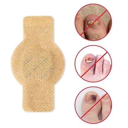 FungaGuard™ — Transform Your Nails Fast for Confidence That Shines Through