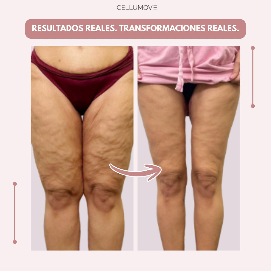 VitaStride™ — Feel Energized Legs and Say Goodbye to Swelling All Day