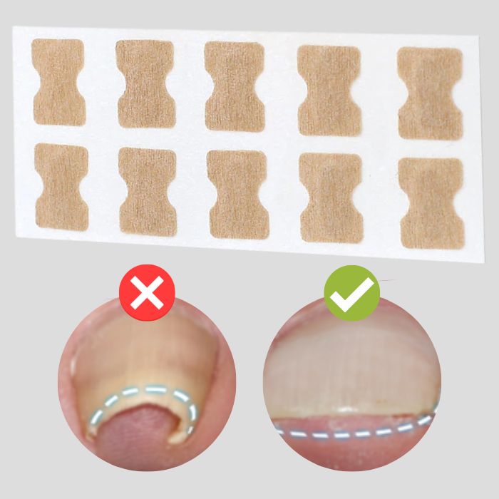 (50% Discount) FinePatches™ | Nail Correction Patches for Healthy and Beautiful Nails