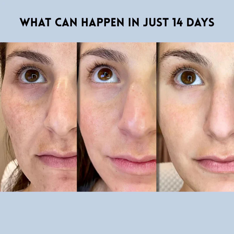 VelaLift™ — Instantly Lift, Hydrate, and Glow Like New Every Day
