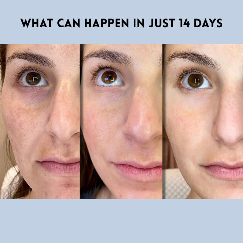 LumaLift™ Strips — Instantly Lift, Smooth, and Radiate Youthful Confidence