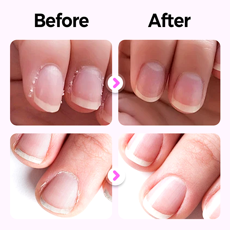 LumaNail™ — Unleash Nail Strength and Scented Elegance That Turns Heads Instantly