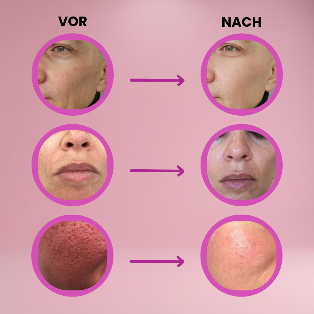 1+1 FREE | Revitaline® | Skin Renewal Balm to Combat Wrinkles