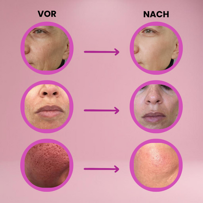 1+1 FREE | Revitaline® | Skin Renewal Balm to Combat Wrinkles