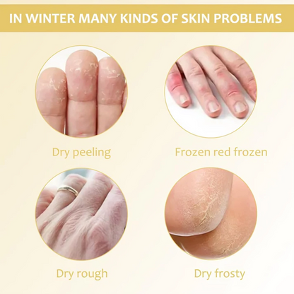 VelvetTouch™ — Heal Dry, Cracked Skin Instantly for Silky, Touchable Smoothness