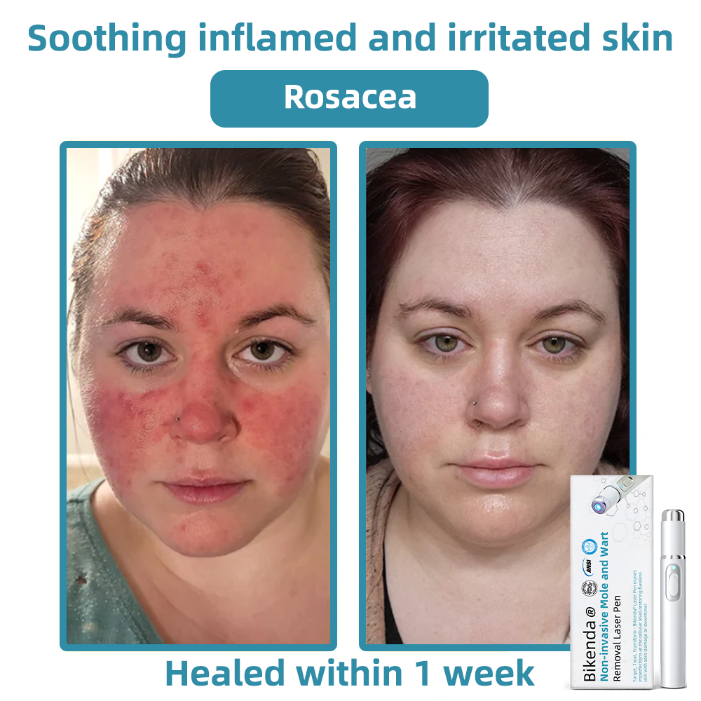 LuminaraTouch™ — Effortless Laser Precision for Radiant, Flawless Skin Fast