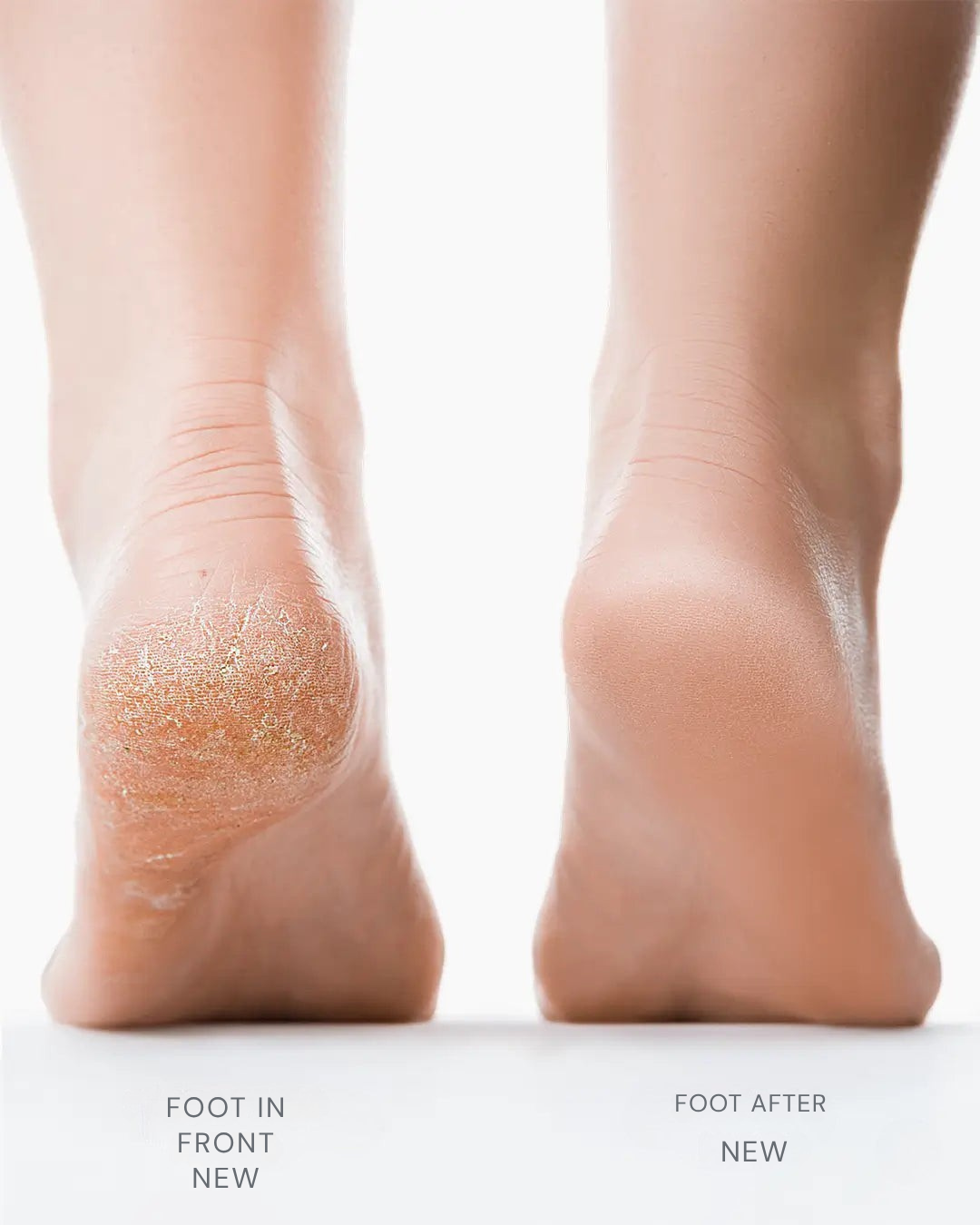 SootheStep™ — Reveal Silky, Confidence-Boosting Feet in Minutes