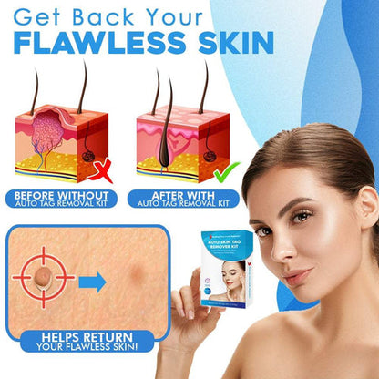 Dermaclear™ — Quickly Reveal Smooth, Tag-Free Skin Without Pain or Scars