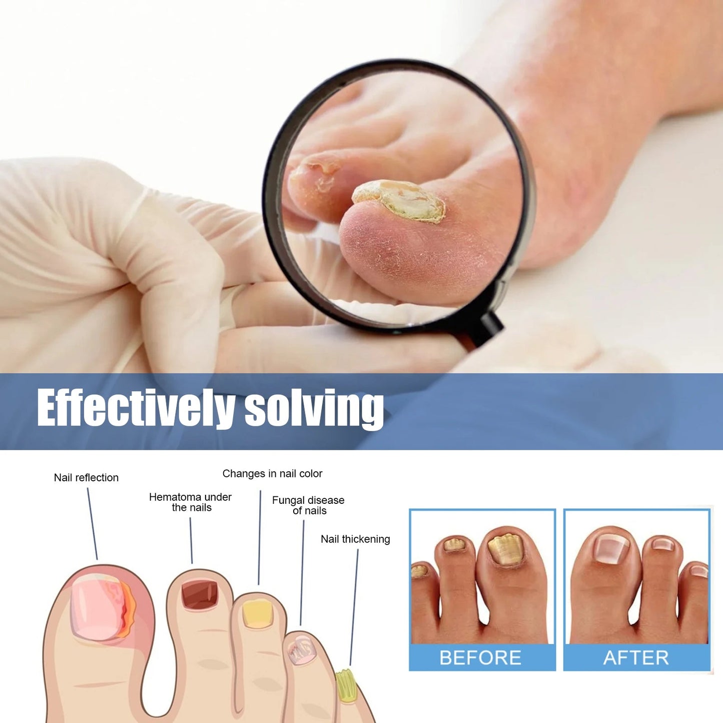NailViveShield™ — Unleash Nail Confidence with Invisible, Powerful Healing
