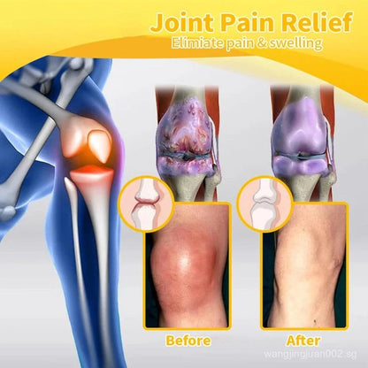 1+1 FREE | HiveRelief™ Get fast, effective relief from joint pain and inflammation!