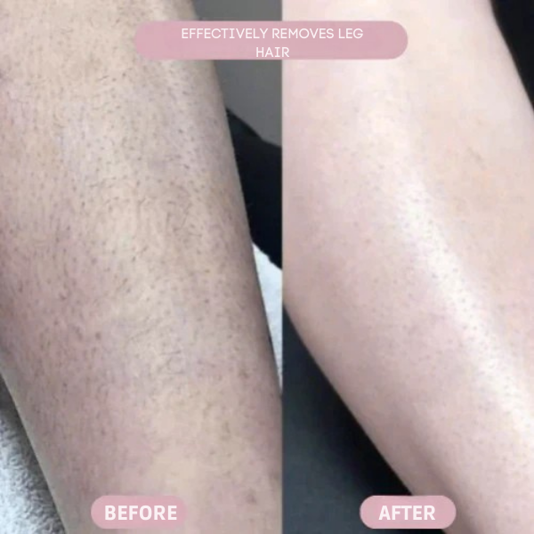 SilkSleek™ — Glide to Gorgeous Skin Without a Single Cut or Irritation