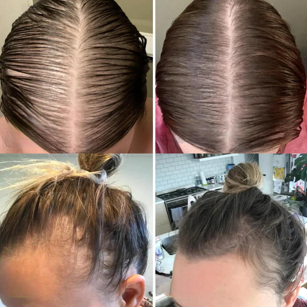 Vogany™ — Stop Hair Loss, Unlock Thick Hair | 50% Off