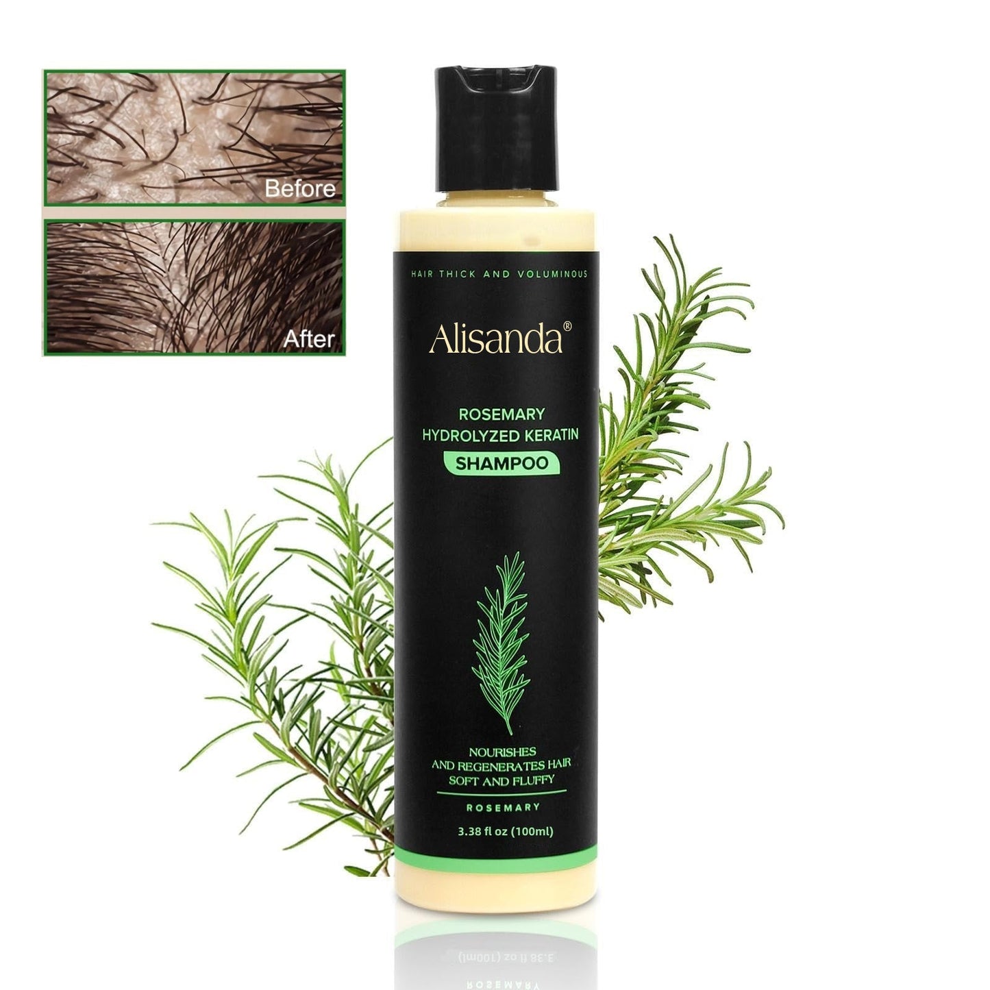 Follicraze™ Shampoo — Awaken Your Scalp for Thicker, Irresistible Hair Every Day