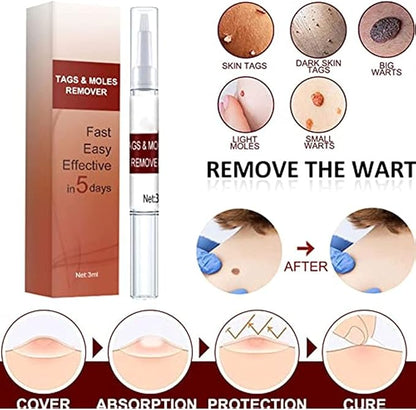 1+1 FREE | SpotWipe™ Gentle Removal
