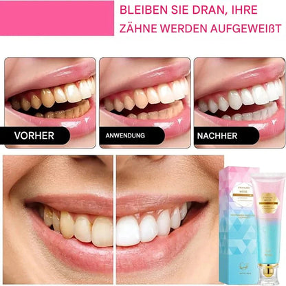PureTeeth™ - Instant Teeth Whitening