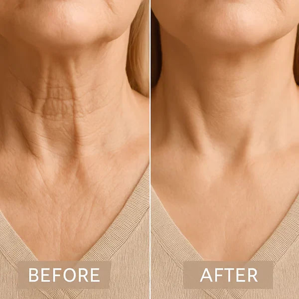 NeckRevive™ — Instantly Lift and Firm for a Youthful, Head-Turning Confidence
