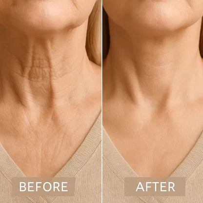 NeckRevive™ — Instantly Lift and Firm for a Youthful, Head-Turning Confidence