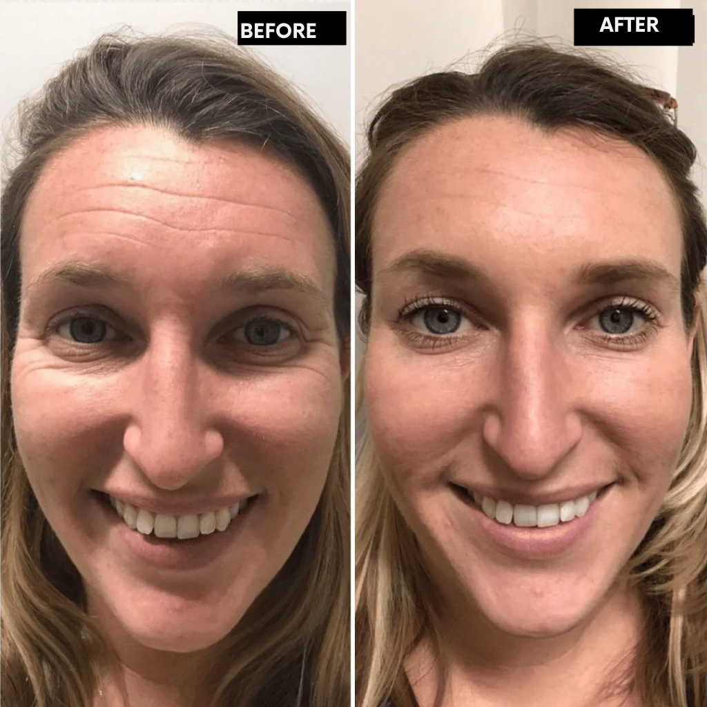 RadiantMuse™ — Reveal Youthful Glow and Smooth, Firm Skin in Just 14 Days