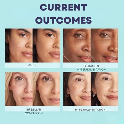 VeloDerm™ — Unlock Effortless Radiance That Lasts All Day Without the Hassle