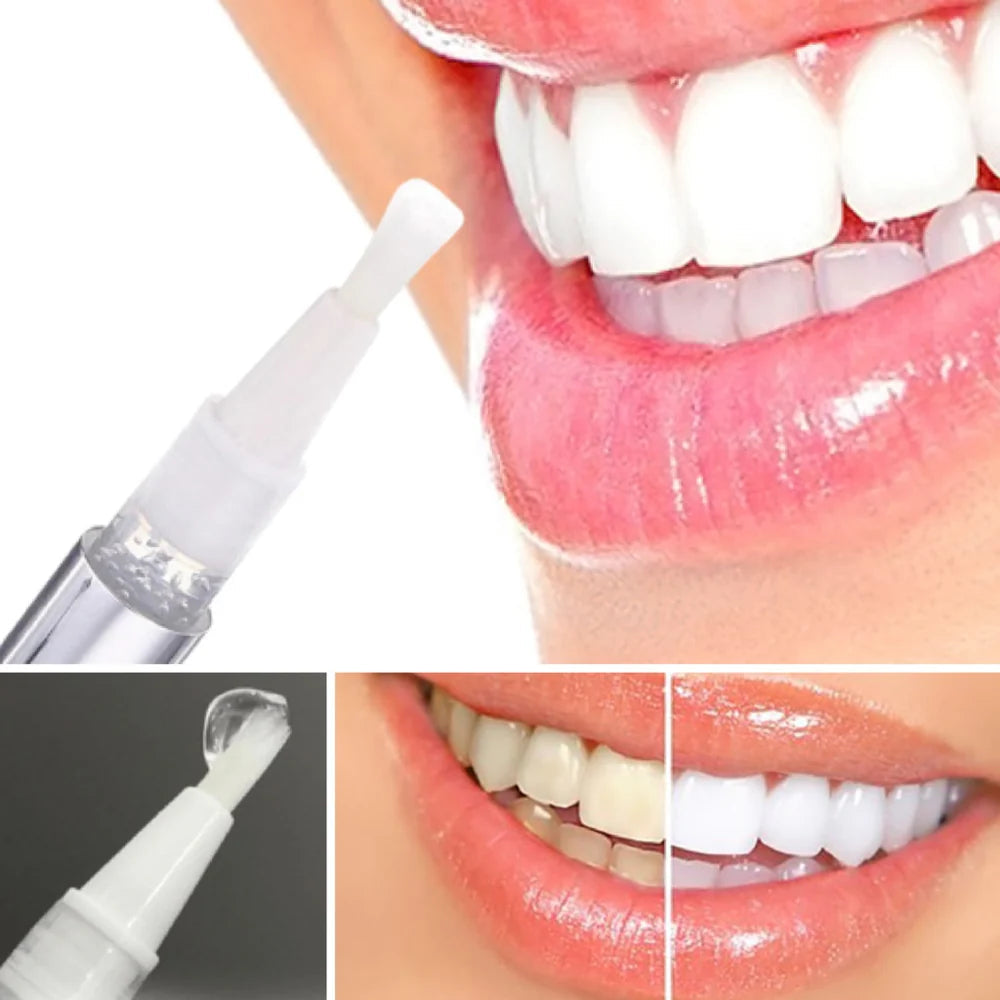LumaShine™ — Unleash a Brilliant Smile That Commands Every Room