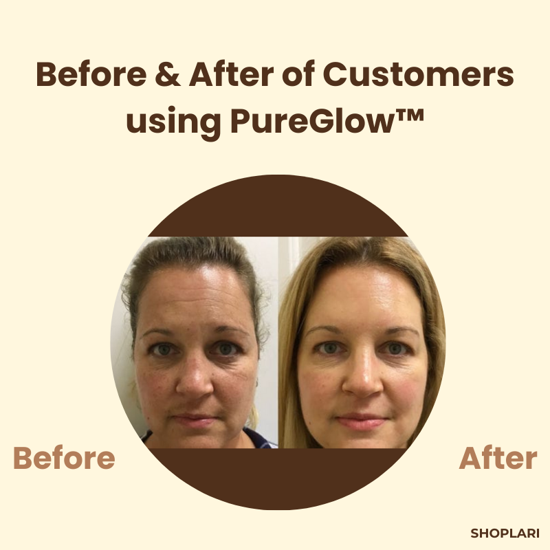 1+1 Free | PureGlow Black Tea Mask™ Minimizes Wrinkles and Fine Lines for Youthful Skin