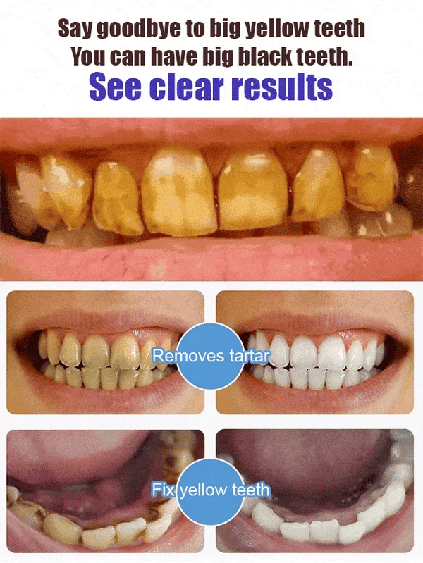ClearGlow™ Probiotic Toothpaste — Stop Plaque and Unlock a Radiant, Confident Smile