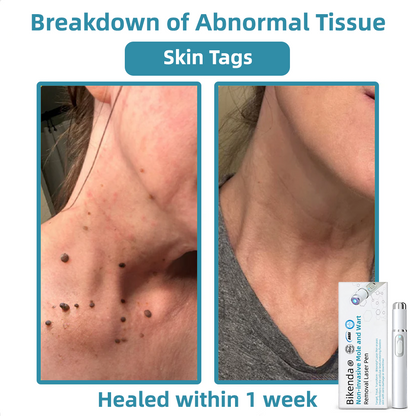 LuminaraTouch™ — Effortless Laser Precision for Radiant, Flawless Skin Fast