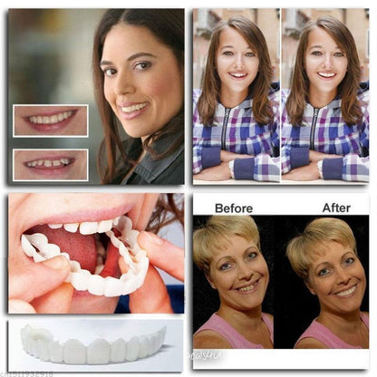 Dentures with Snap-On Design