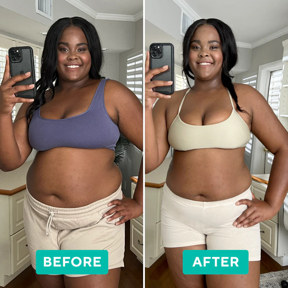 SculptEase™ — Melt Fat and Reveal Smooth, Confident Curves Fast