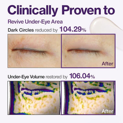 ViviLuxe™ Radiance Eye Cream — Reveal Bright, Youthful Eyes That Command Attention