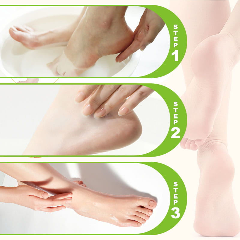 SilkVive™ Foot Renewal Cream — Transform Rough, Tired Feet into Irresistible Softness