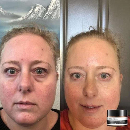 LumaRise™ Eye Renewal Cream — Wake Up to Instantly Younger, Brighter Eyes That Dazzle Every Day