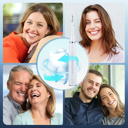 SmileBlast™ — Deep Clean for a Radiant Smile | 50% Off