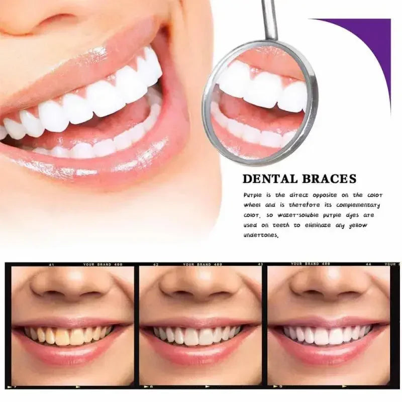Brillora™ — Unlock an Instant, Pain-Free Smile That Turns Heads Everywhere