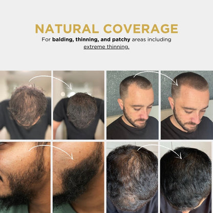 Covrix™ — Instantly Thicken Hair and Own Every Confident Moment