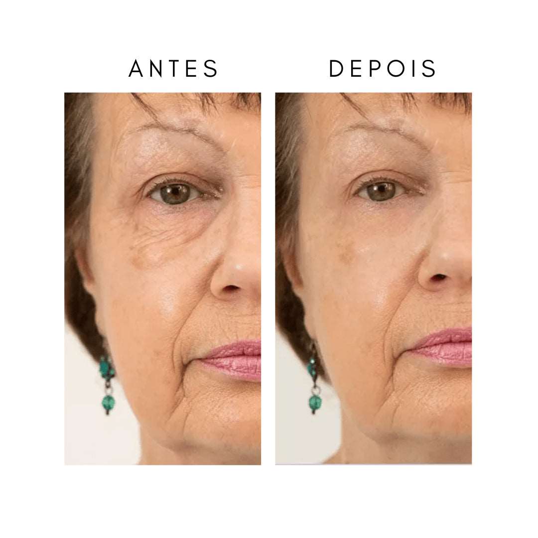 LumaRise™ Eye Renewal Cream — Wake Up to Instantly Younger, Brighter Eyes That Dazzle Every Day