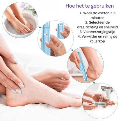 FootRenew™ - Eliminate Painful Calluses with Professional-Grade Strength and Comfort