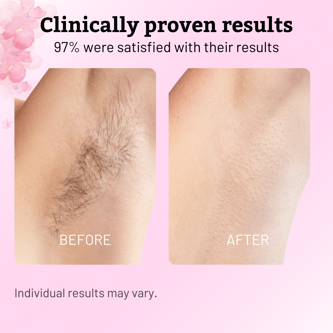 GlimmerEase™ — Unlock Silky-Smooth Skin Without Pain or Hassle