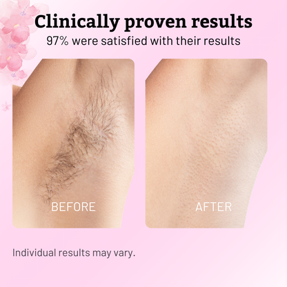 GlimmerEase™ — Unlock Silky-Smooth Skin Without Pain or Hassle