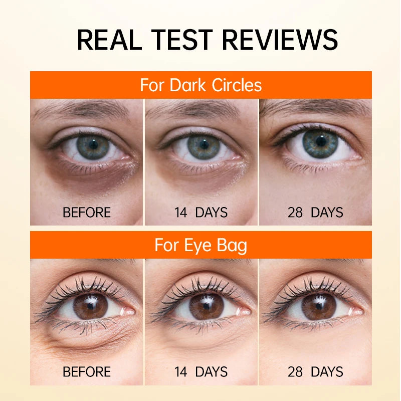 LumenaLift™ — Ignite Youthful Eyes That Command Attention Instantly