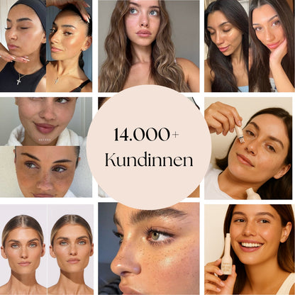 FrecklEase™ — Unlock Your Effortless, Sun-Kissed Confidence Instantly