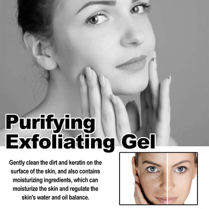 ClearSkin Peeling Gel – Achieve Radiant Skin in Just 1 Minute!