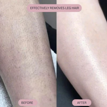 VeelaSmooth™ — Experience Blissful, Bump-Free Skin That Boosts Your Confidence Every Day