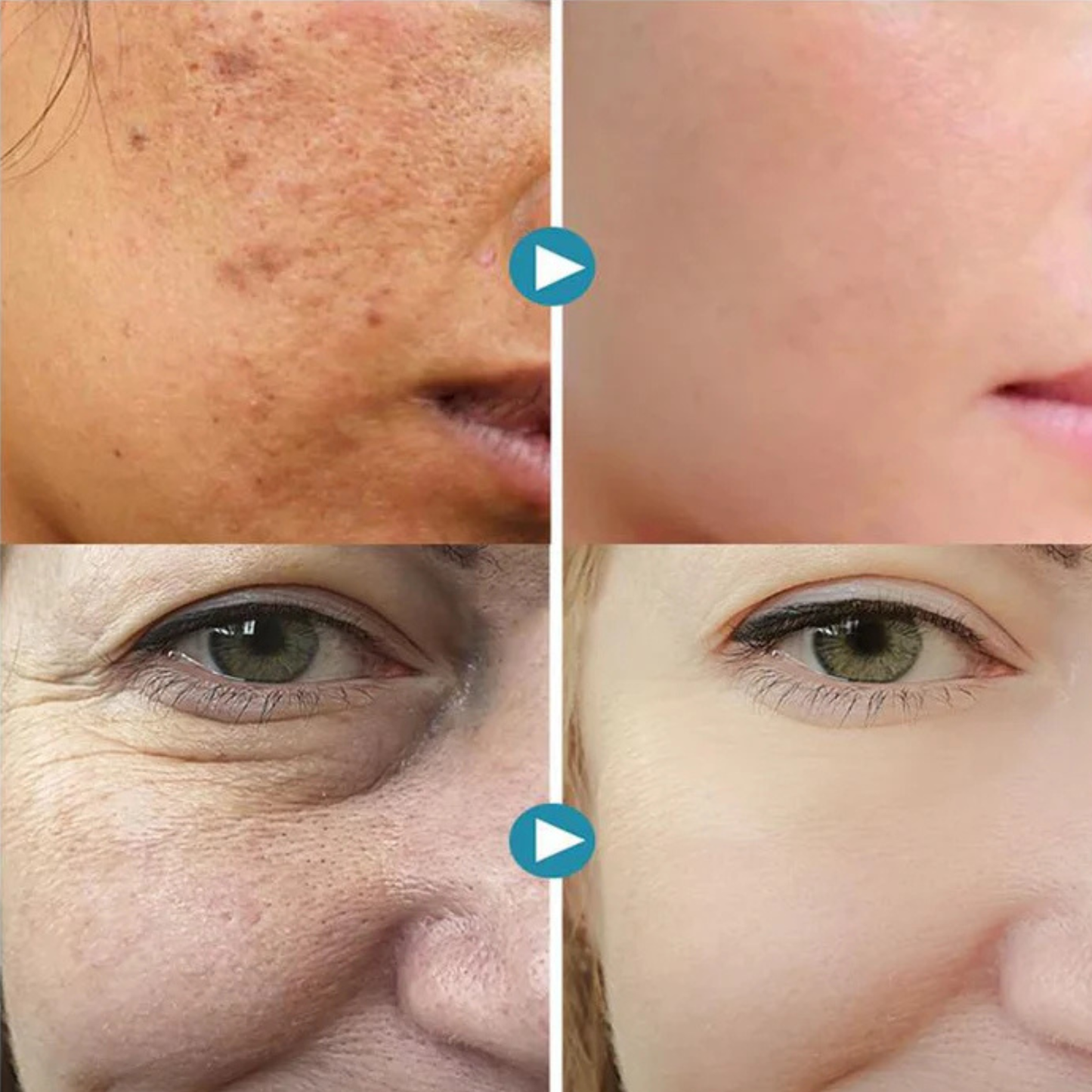 DermaLuxe™ Pore-Refining Gel — Transform Your Skin to Silky Smooth, Radiant Perfection Every Day