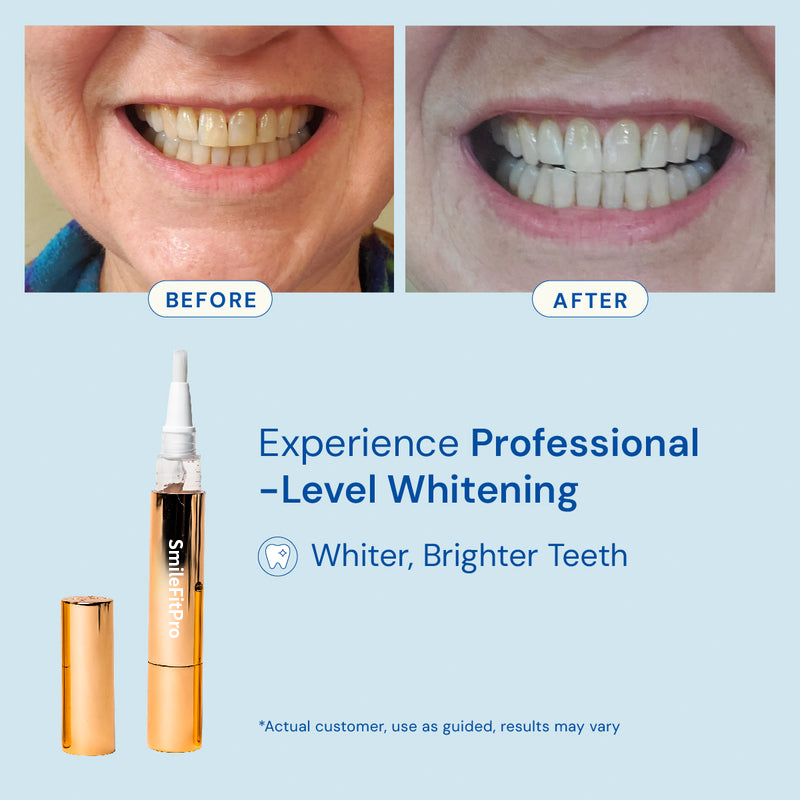 BrilliaWhite™ Teeth Whitening Serum — Instantly Ignite Your Smile and Confidence Everywhere You Go