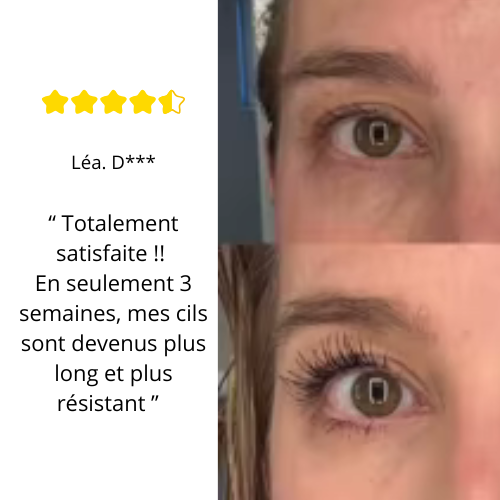LashFervor™ — Ignite Irresistible Lashes That Command Every Glance
