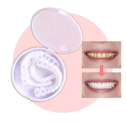 Snap-on Smile™ — Effortless Flawless Confidence | 50% Off
