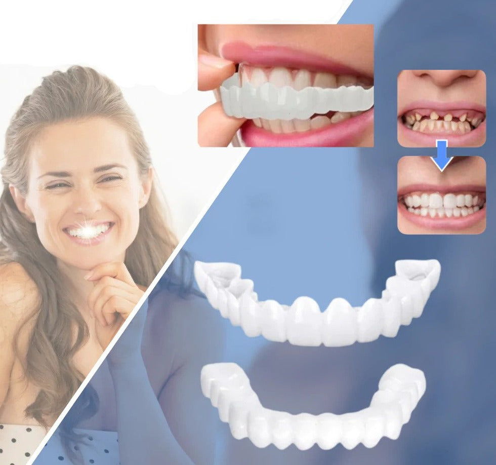Snap-on Smile™ — Effortless Flawless Confidence | 50% Off