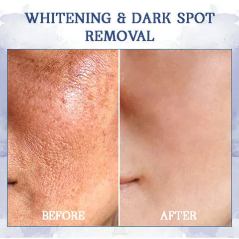 🥥𝐋𝐚𝐬𝐭 𝐃𝐚𝐲 𝐃𝐢𝐬𝐜𝐨𝐮𝐧𝐭: 𝟕5% 𝐎𝐅𝐅🫧 Advanced Fat-Burning & Firming Cream: Remove Excess Fat and Revitalize Skin Elasticity